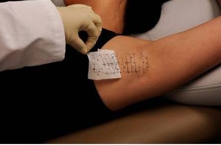 Bien phap chua hoi nach chi sau mot lan dieu tri hinh anh