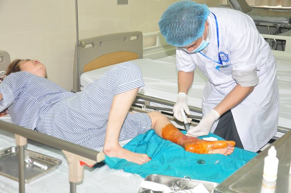 cắt cụt chi ảnh 1 cat cut chi anh 1