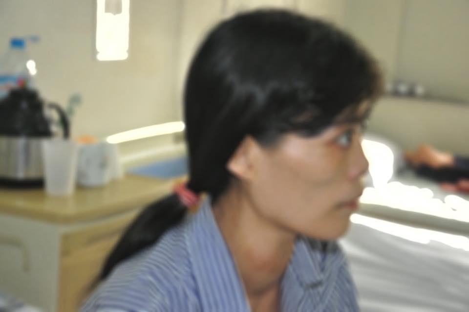 Tự chữa bệnh basedow ảnh 1 Tu chua benh basedow anh 1