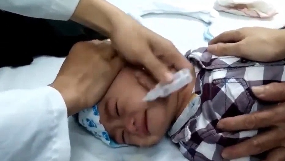 Cach rua nuoc muoi cho tre khi bi so mui hinh anh
