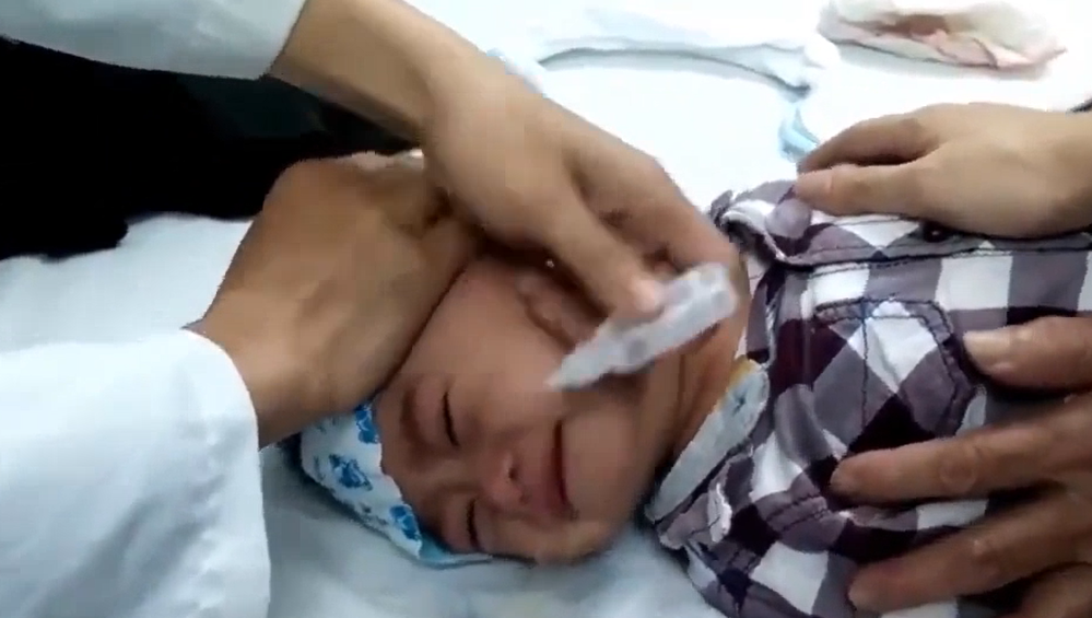 Bac si huong dan cach rua mui cho tre het nuoc mui hinh anh