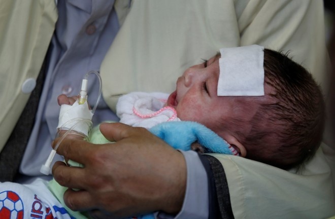 Loai vac xin nao se thay the Quinvaxem? hinh anh