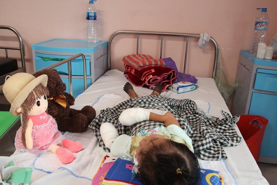 bé gái 3 tuổi phải cắt bỏ tứ chi ảnh 2 be gai 3 tuoi phai cat bo tu chi anh 2