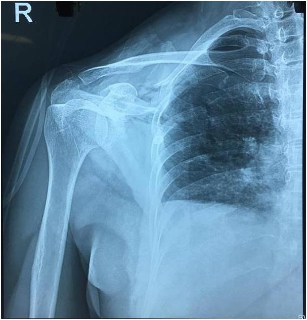 bệnh nhân có nhóm máu hiếm ảnh 1 benh nhan co nhom mau hiem anh 1