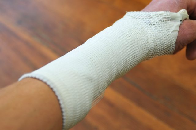 Nguoi dan ong bat ngo tu vong sau ca mo gay xuong cang tay hinh anh