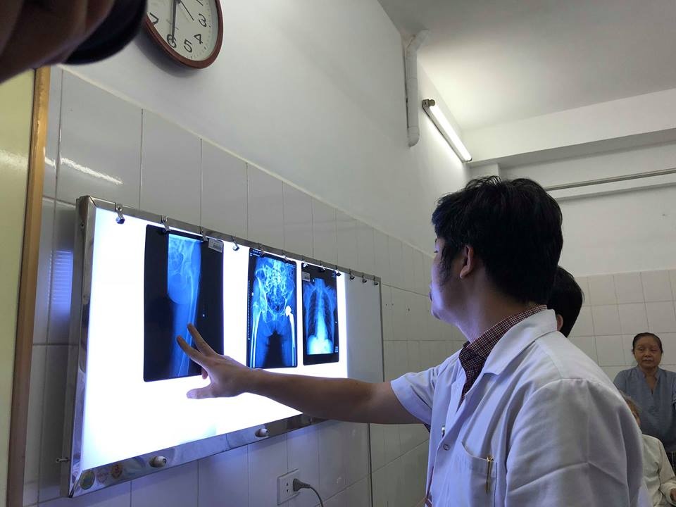 Thay khớp háng bán phần ảnh 1 Thay khop hang ban phan anh 1