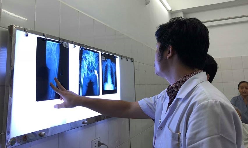 Cu ba 104 tuoi khoe manh sau ca thay khop hang ban phan hinh anh