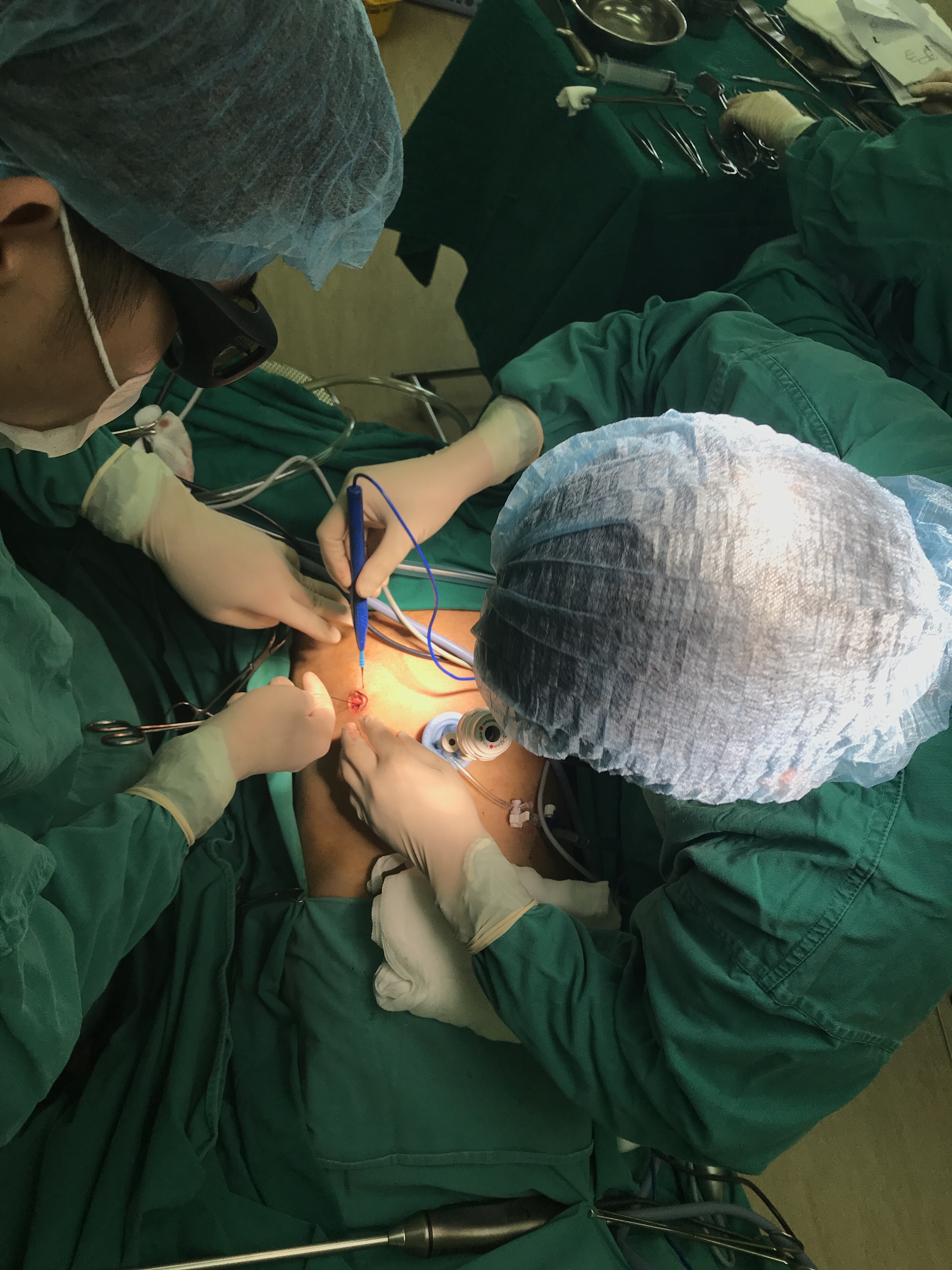 Viet Nam lan dau phau thuat noi soi 3D mot lo cho benh nhan ung thu hinh anh