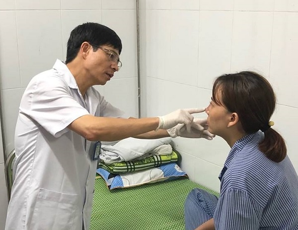 bien chung nang ne sau khi nang mui bang filler anh 2