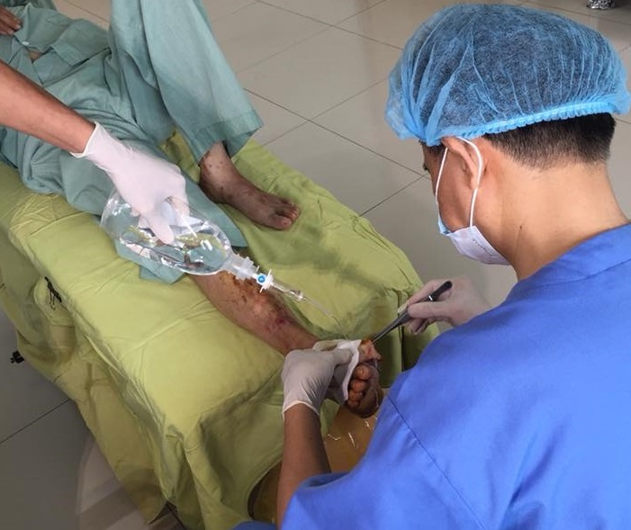 Benh nhan tieu duong phai cat bo ngon chan vi luoi uong thuoc hinh anh