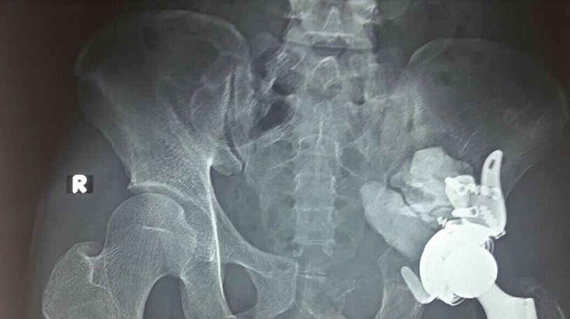 u o coi xuong chau hiem gap anh 1