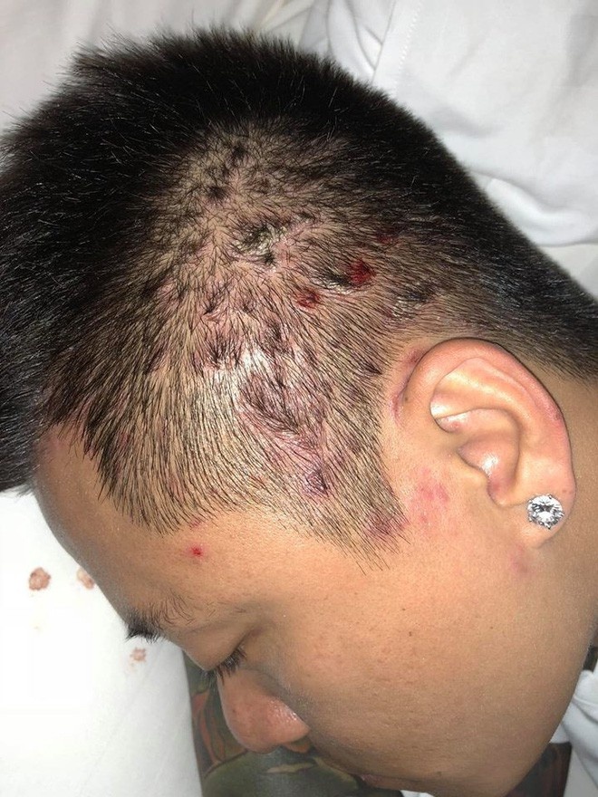 Căn bệnh ca sĩ Tuấn Hưng mắc ảnh 1 Can benh ca si Tuan Hung mac anh 1