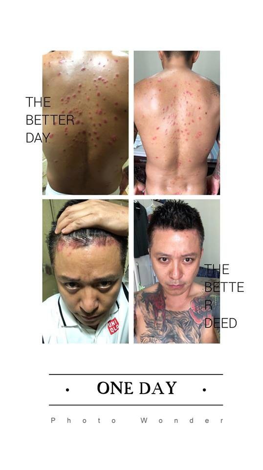 Căn bệnh ca sĩ Tuấn Hưng mắc ảnh 2 Can benh ca si Tuan Hung mac anh 2