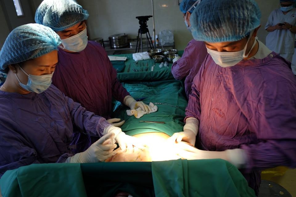 phì đại tuyến vú  ảnh 2 phi dai tuyen vu anh 2