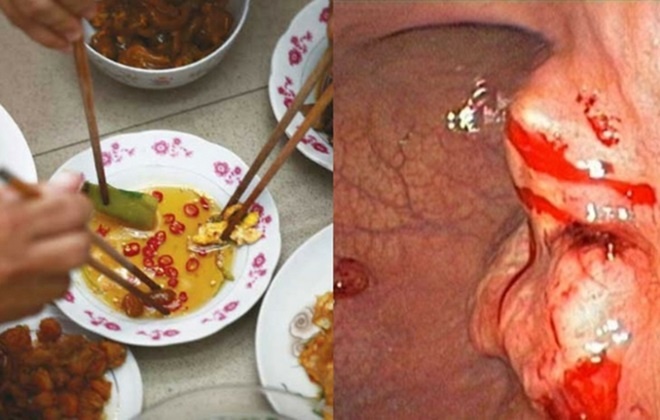 Cham chung nuoc mam can trong lay benh hinh anh