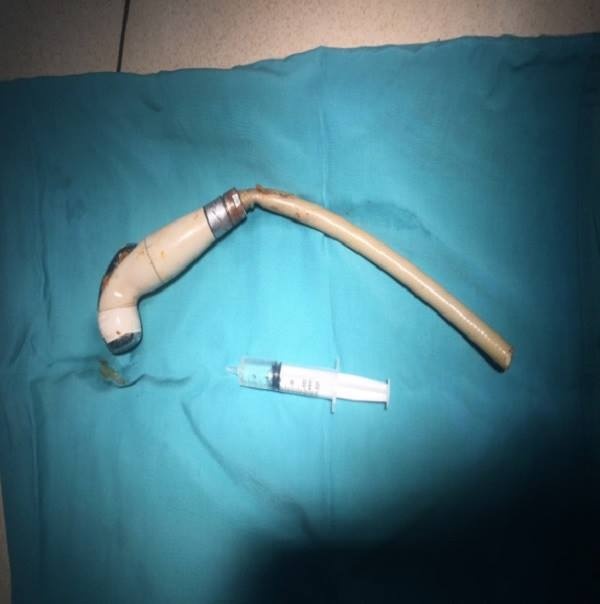 Nam thanh nien bi voi xit dam sau vao hau mon khi di dai tien hinh anh