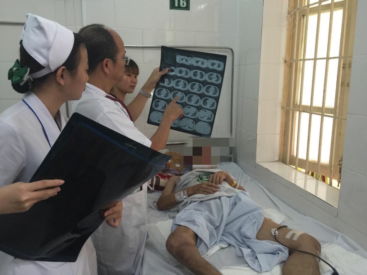 mắc bệnh Whitmore ảnh 1 mac benh Whitmore anh 1