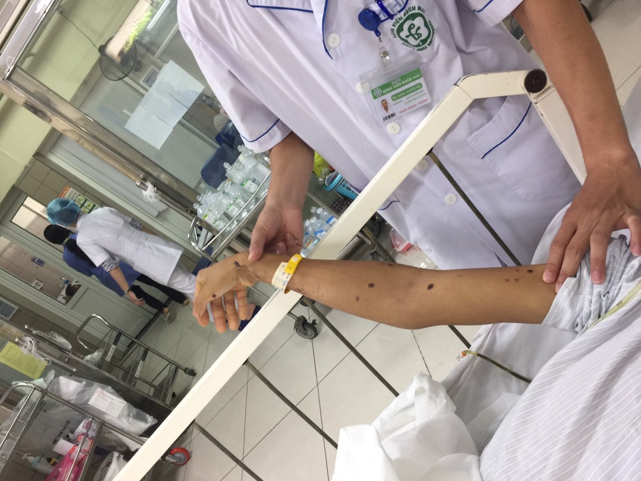 Suy đa tạng vì ong đốt ảnh 2 Suy da tang vi ong dot anh 2