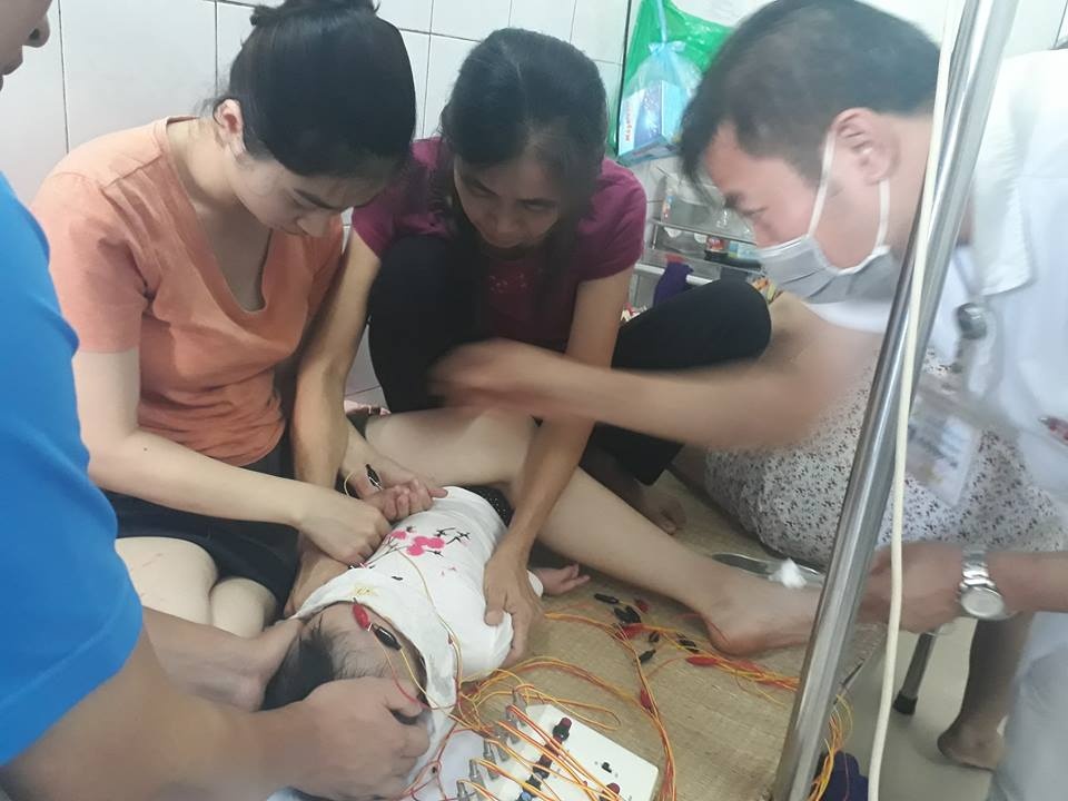 Be gai 12 thang tuoi liet mat nghi do nam dieu hoa lanh hinh anh