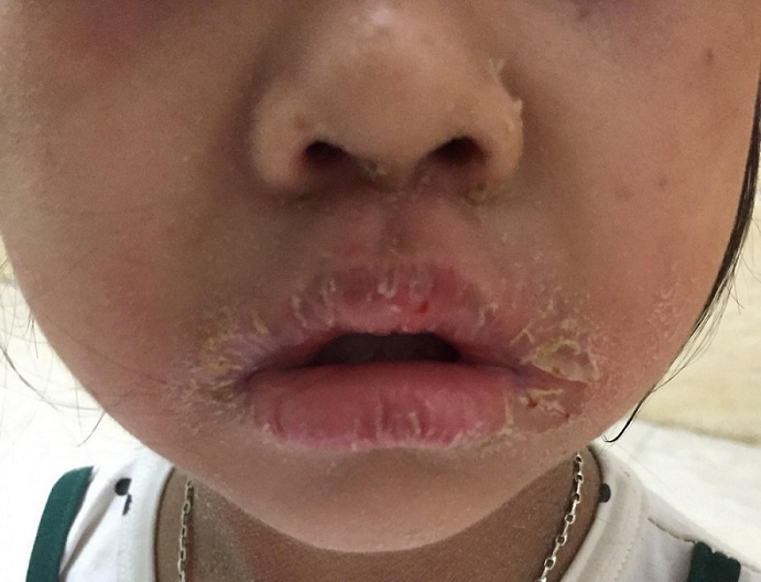 Be gai bong troc toan than nhu da ran do hoi chung la hinh anh