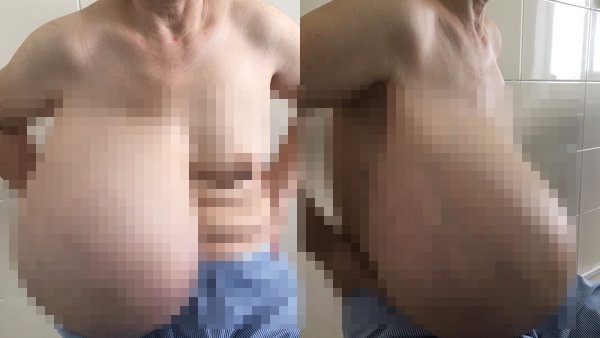 ngực khủng 9 kg ảnh 1 nguc khung 9 kg anh 1