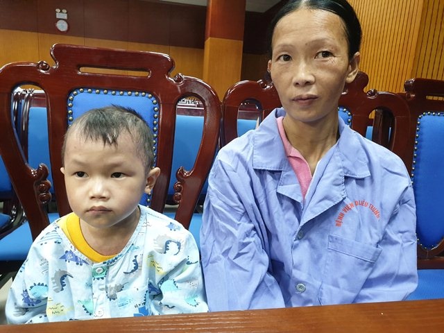 Bé trai mắc vảy nến nặng ảnh 2 Be trai mac vay nen nang anh 2