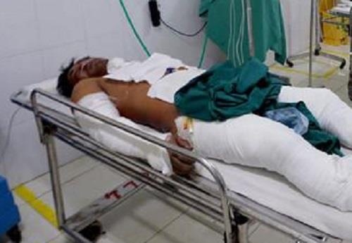 Bong vi bi tam xang len nguoi nguy hiem nhu the nao? hinh anh