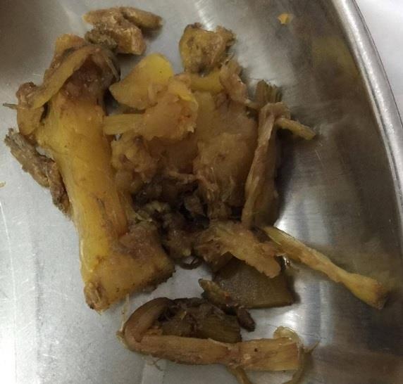 Người đàn ông bị tắc ruột  ảnh 1 Nguoi dan ong bi tac ruot anh 1