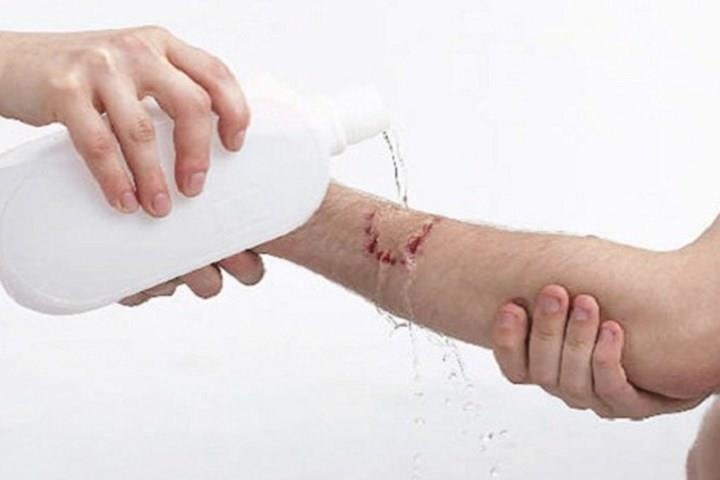 5 su that can biet ve benh dai hinh anh