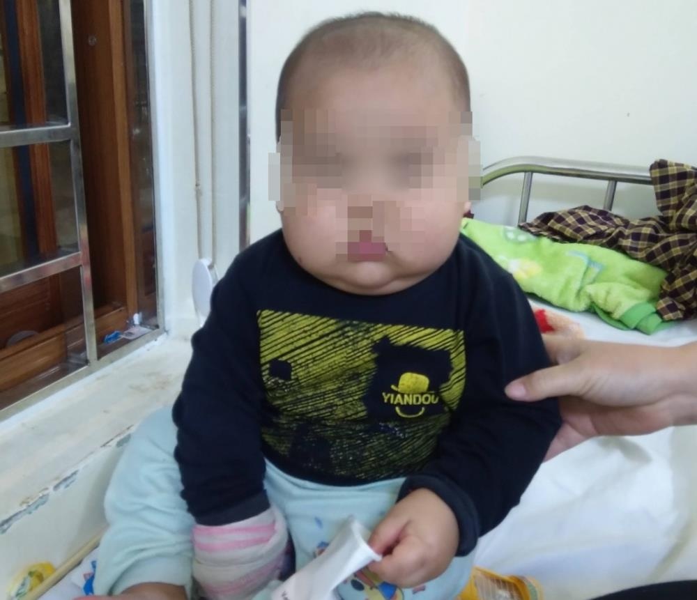 suy thuong than anh 1