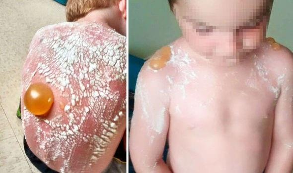 benh ly nguy hiem do tia cuc tim gay ra voi da anh 1