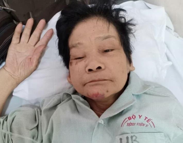 tìm người thân cho nữ bệnh nhân  ảnh 1 tim nguoi than cho nu benh nhan anh 1