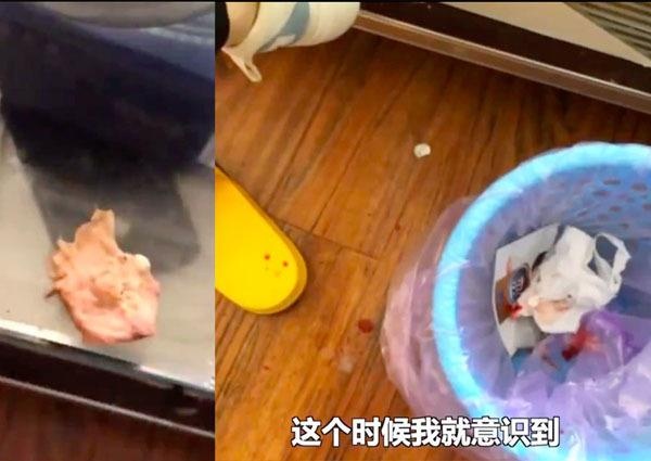 6 thang sau khi nang mui anh 1