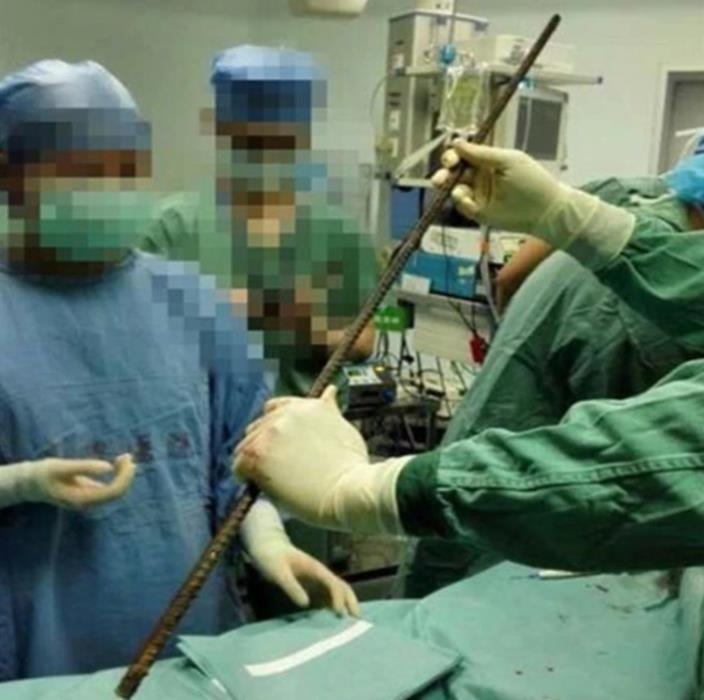 bị thanh sắt đâm xuyên ảnh 1 bi thanh sat dam xuyen anh 1