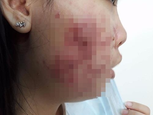 Hong mat vi dung my pham trang da anh 1