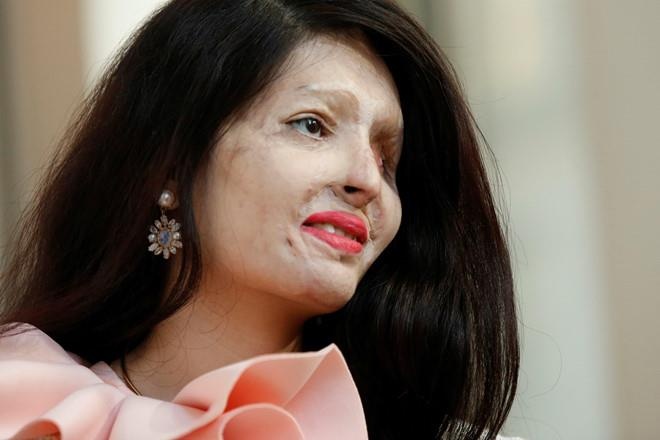 Tấn công axit ảnh 2 Tan cong axit anh 2