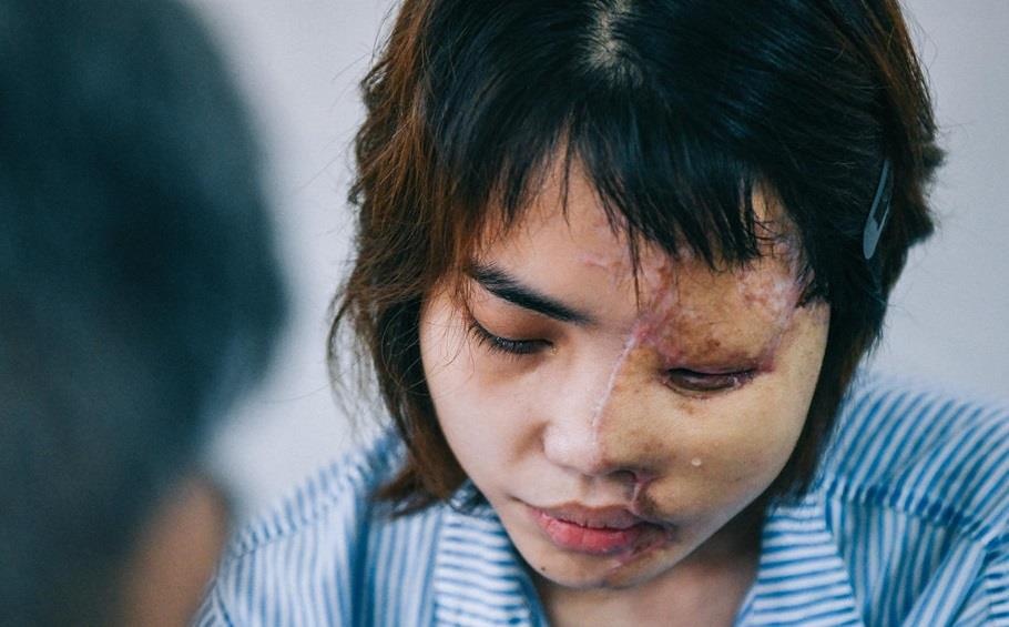 Tan cong bang axit - van nan khien the gioi vung vay keu khoc hinh anh