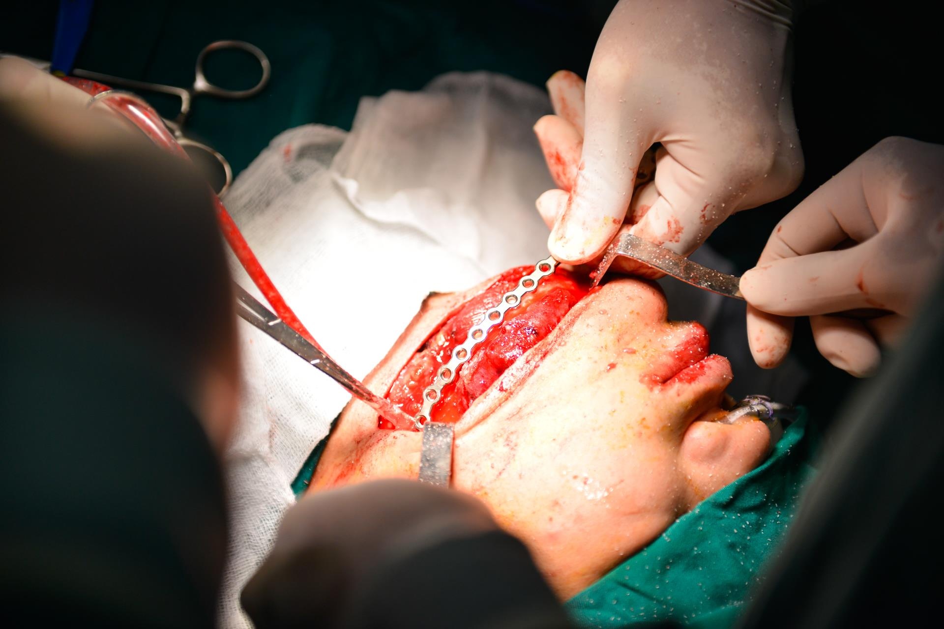 bac si loi xuong chan lam ham rang anh 8