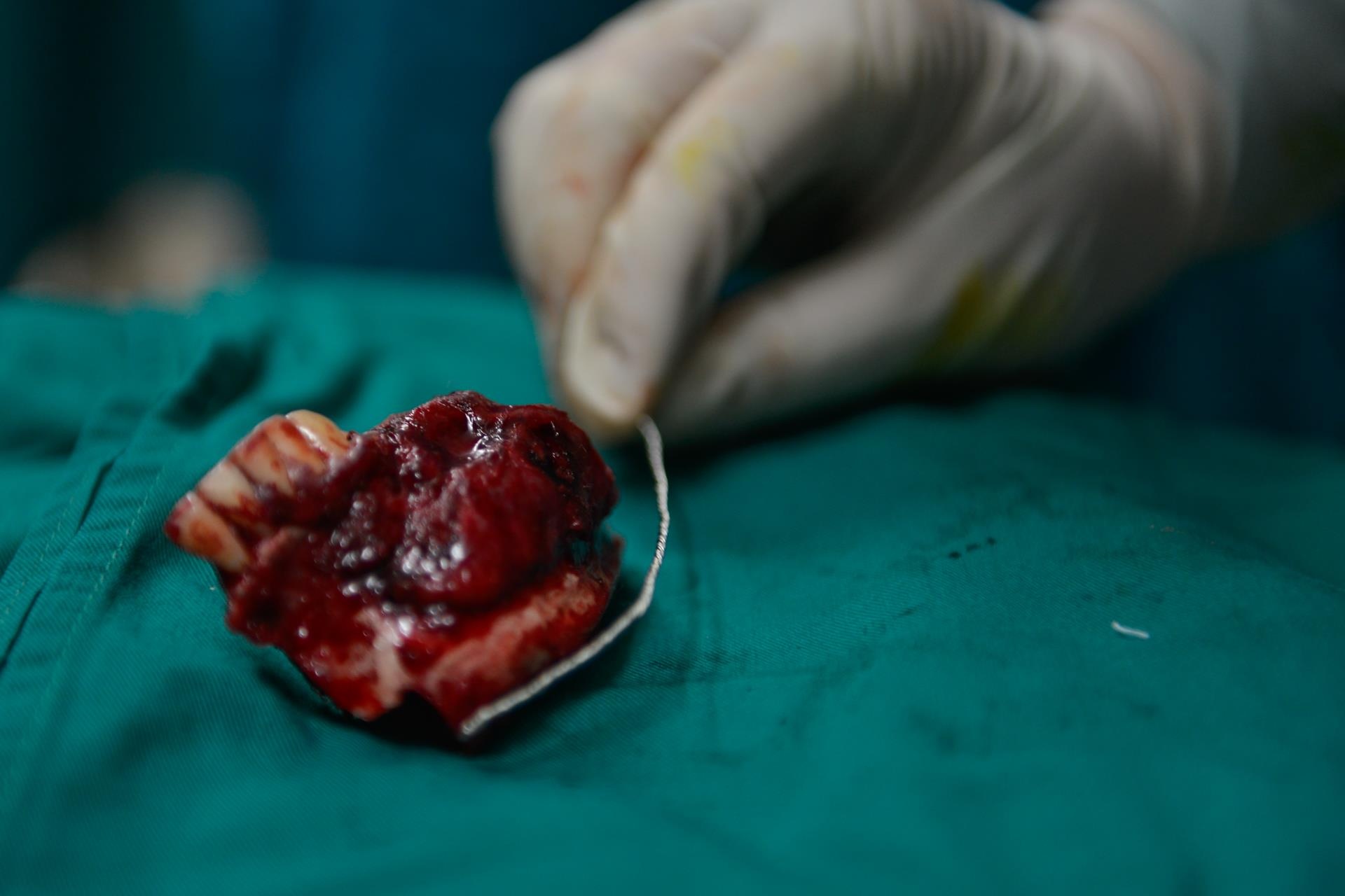 bac si loi xuong chan lam ham rang anh 9