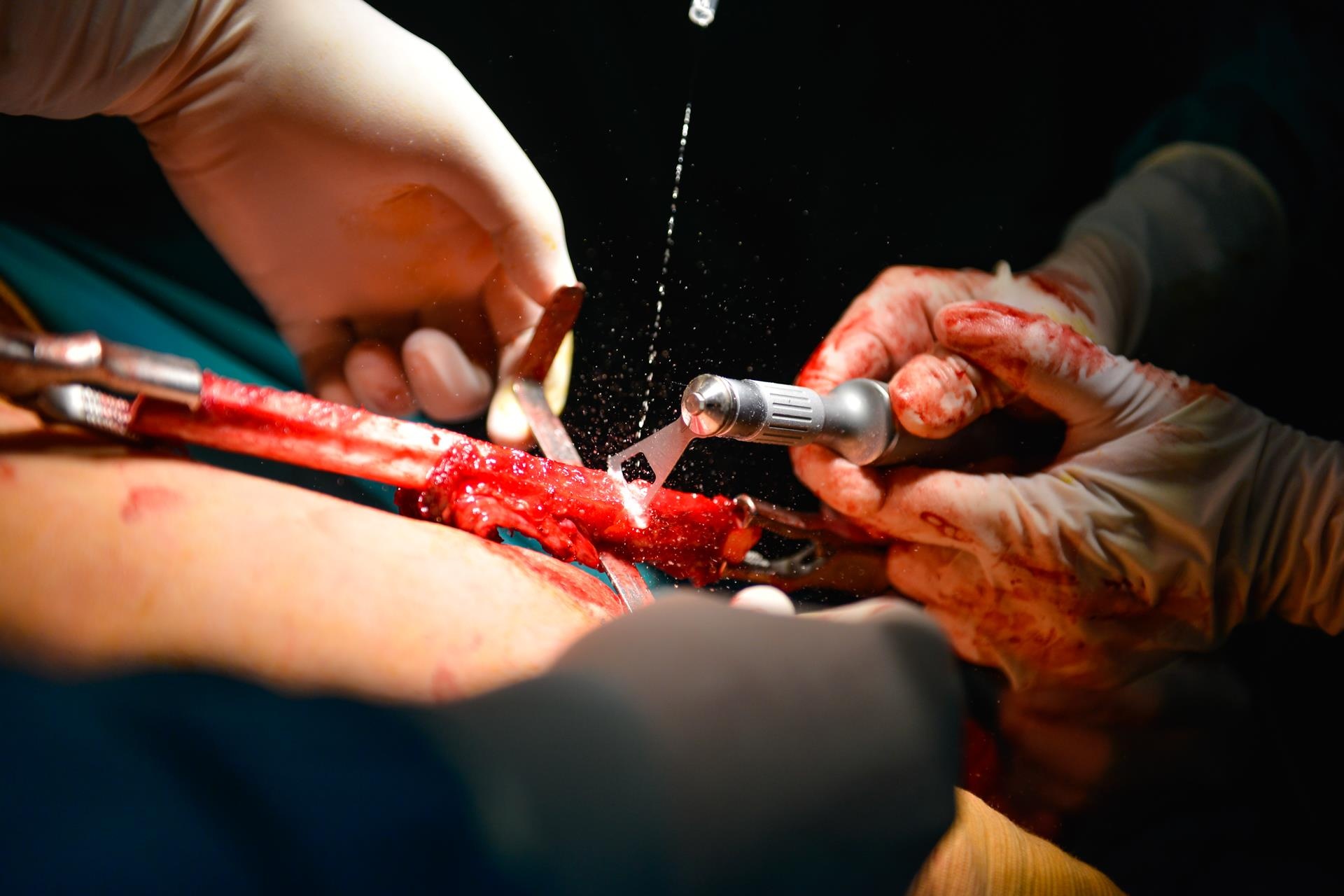 bac si loi xuong chan lam ham rang anh 10