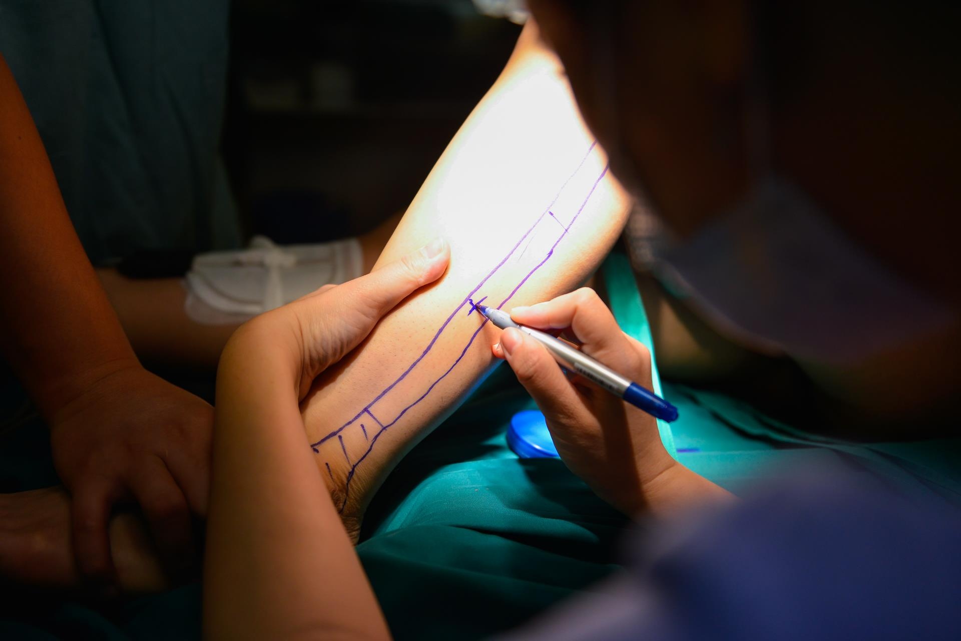 Canh bac si loi xuong chan lam ham cho benh nhan hinh anh