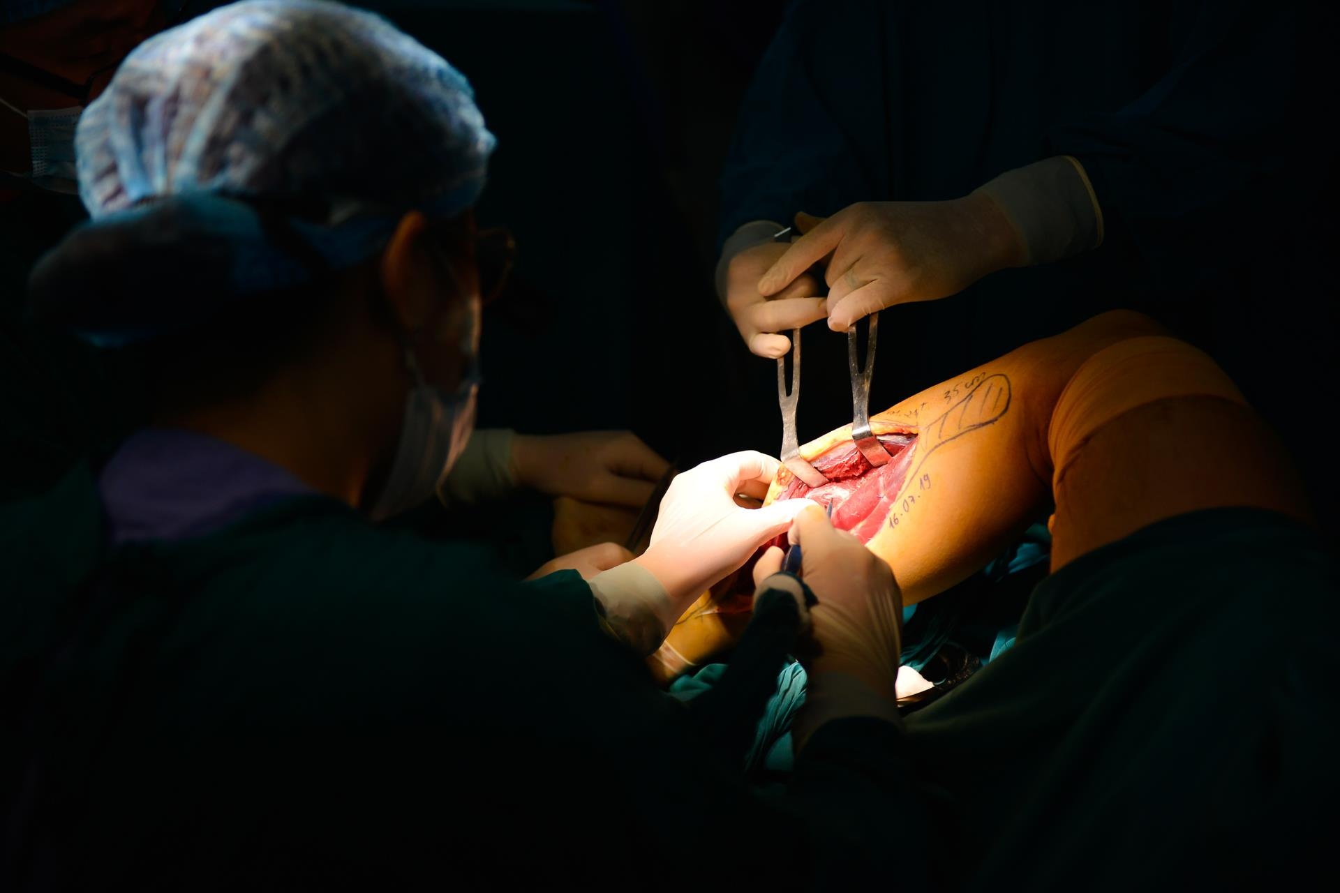 bac si loi xuong chan lam ham rang anh 7