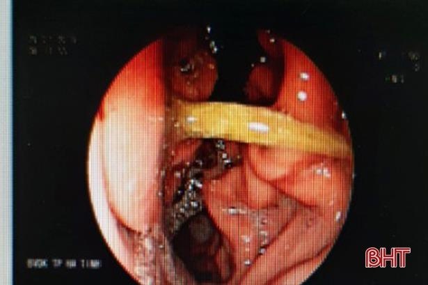 tam dam thung da day anh 1