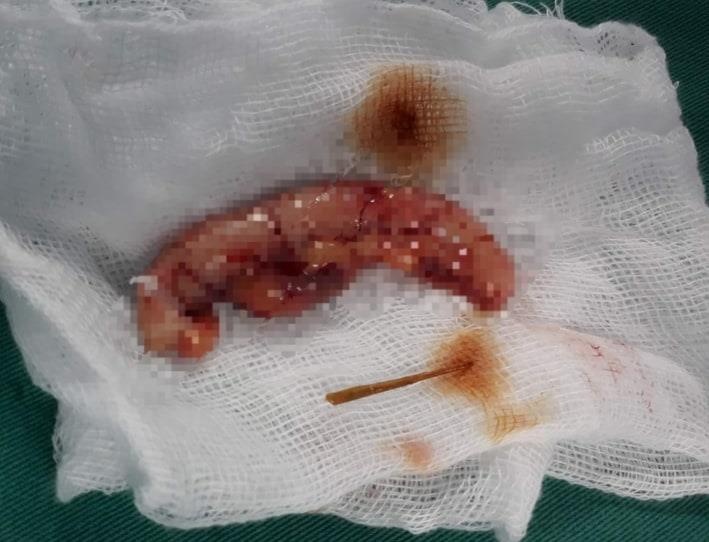 tam xia rang dam thung ruot thua anh 1