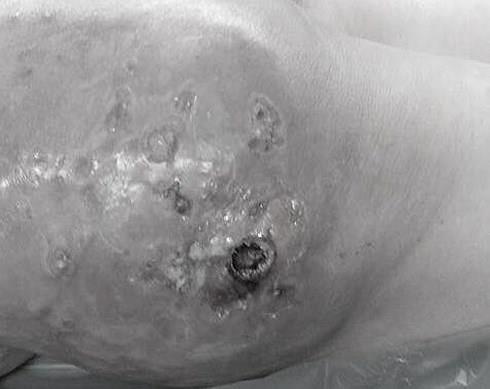 nang mong bang silicon long anh 1