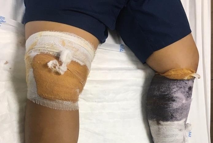 Trẻ 7 tuổi bị chó nhà hàng xóm lao vào tấn công ảnh 1 Tre 7 tuoi bi cho nha hang xom lao vao tan cong anh 1