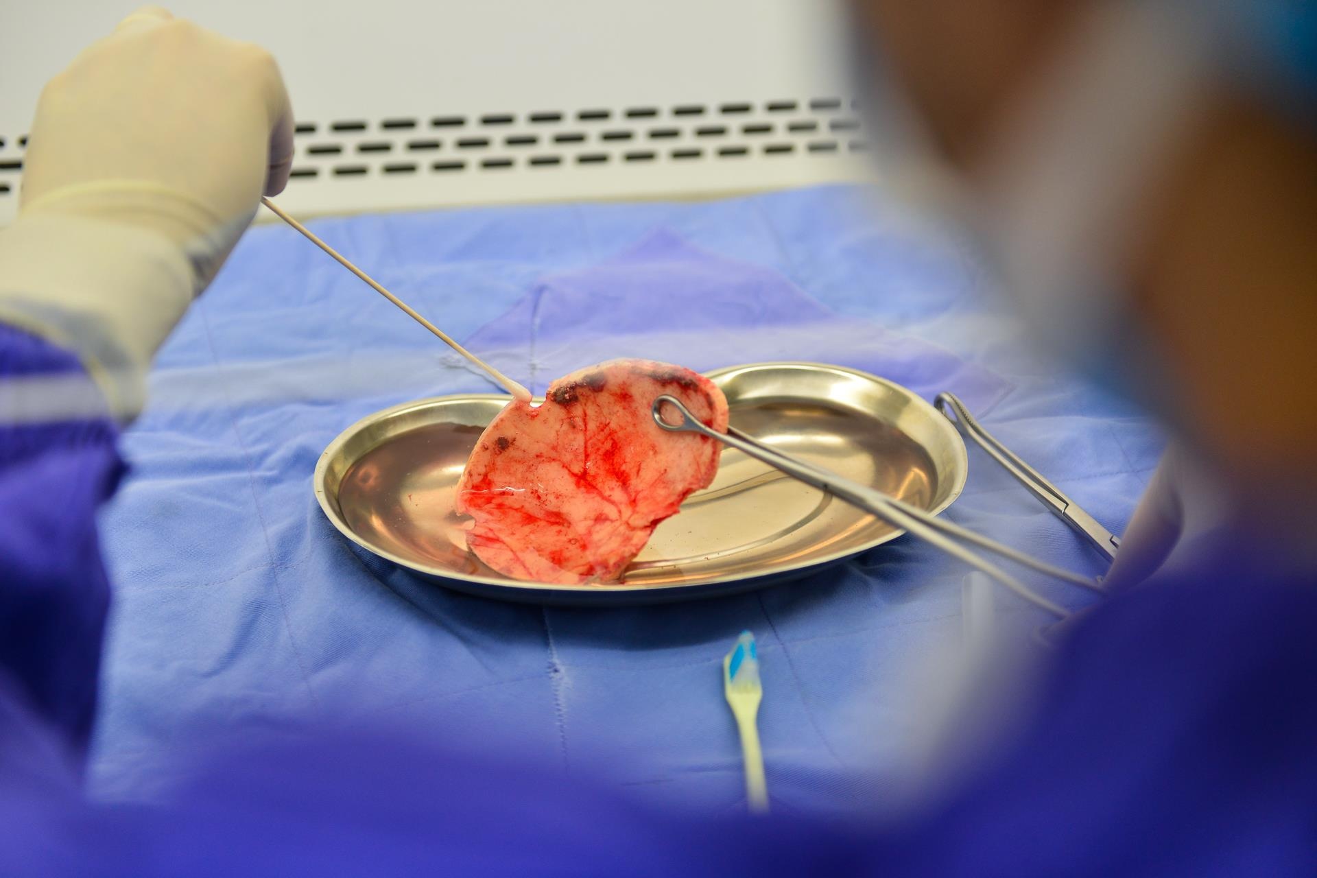 Ben trong ngan hang mo anh 6