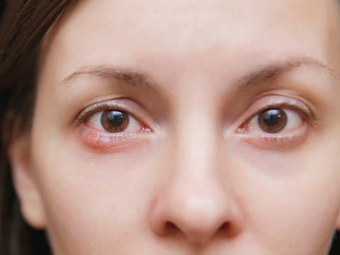 Nhieu nguoi Viet bi mu vinh vien do can benh de bo qua hinh anh