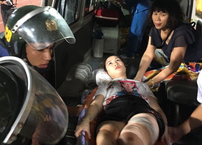 Nữ cổ động viên trúng pháo sáng phải phẫu thuật  ảnh 1 Nu co dong vien trung phao sang phai phau thuat anh 1
