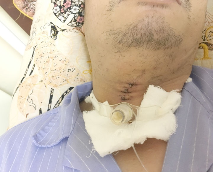 da mai ban vao co anh 1